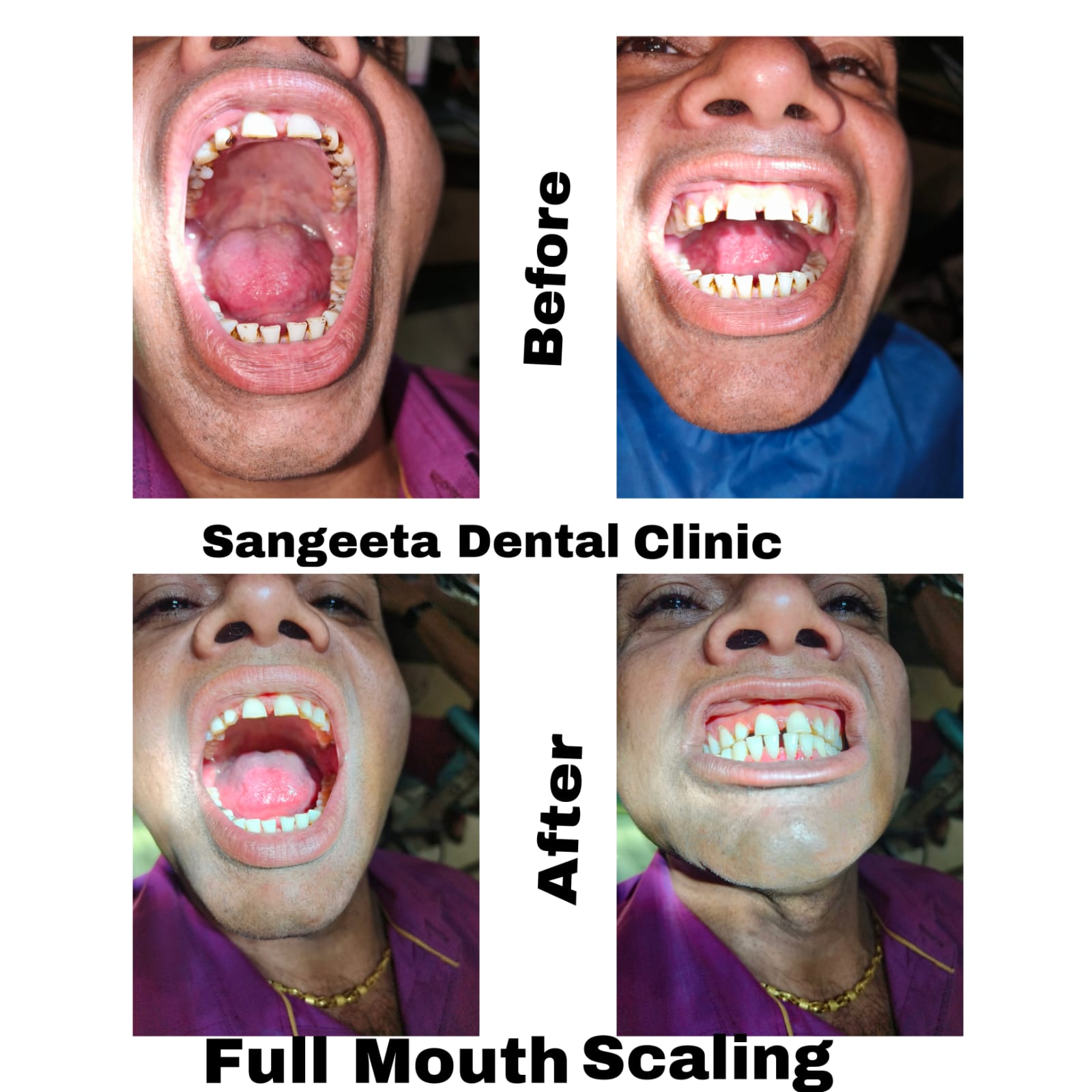 Dental Procedure