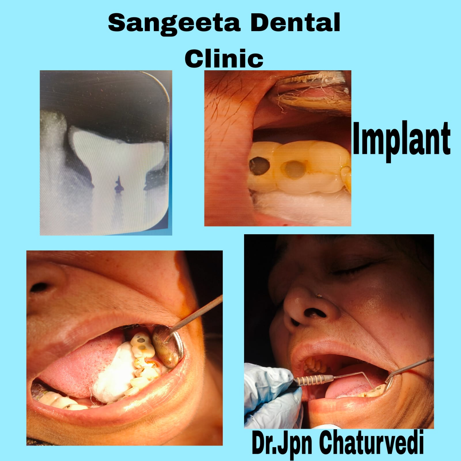 Dental Procedure