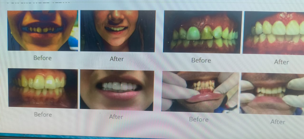 Dental Procedure